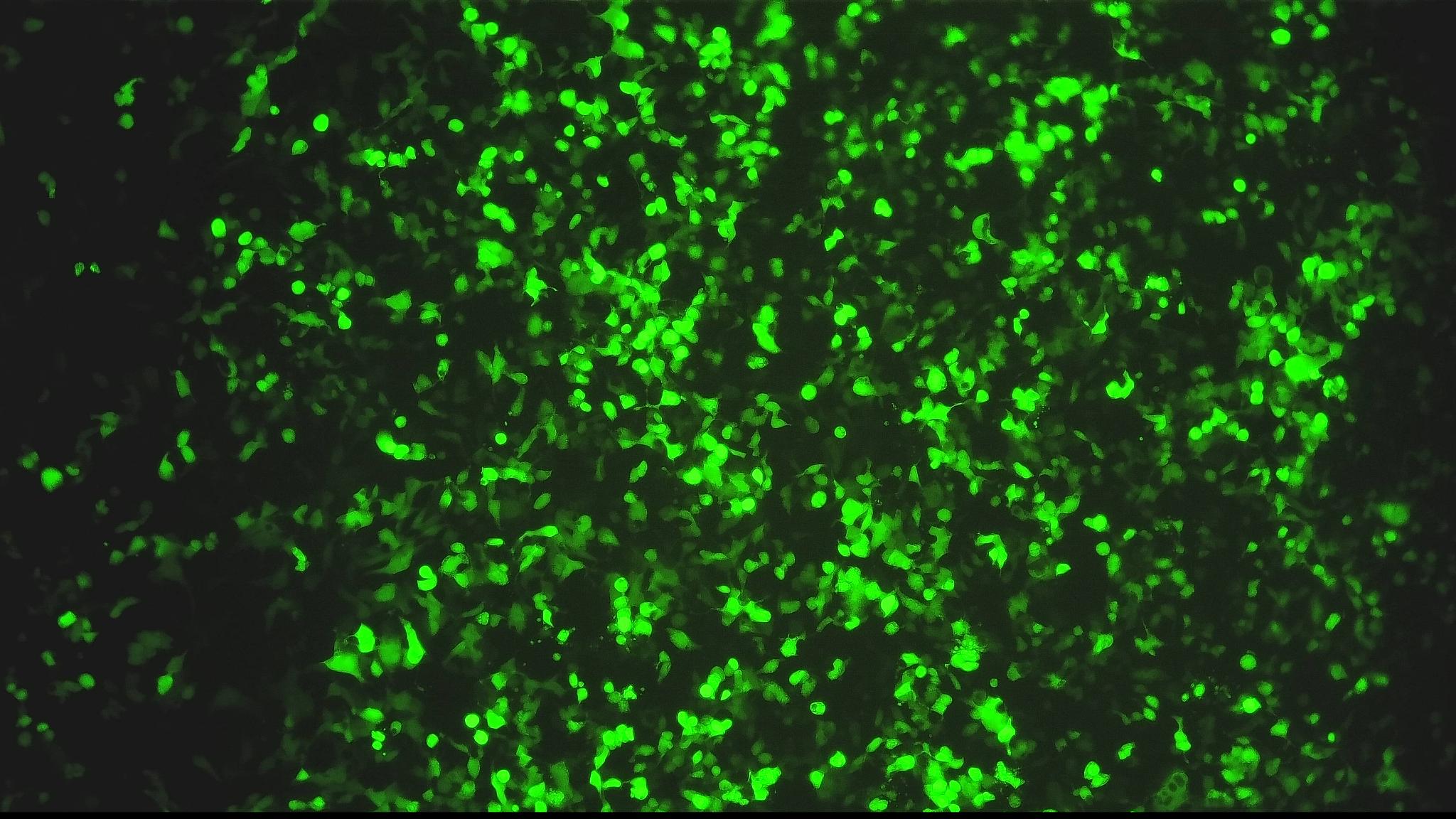 GFP-transfected cells under fluorescence microscopy